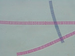 MISSING THUMBNAIL